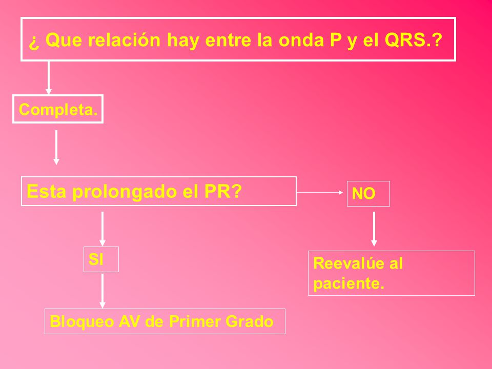 ¿ Que relación hay entre la onda P y el QRS.