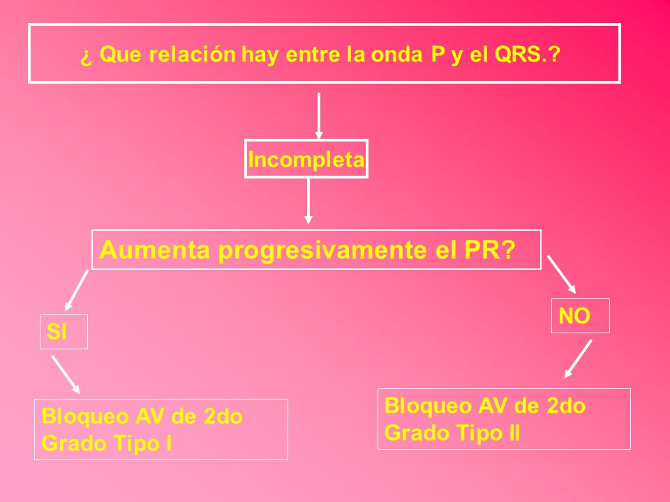 ¿ Que relación hay entre la onda P y el QRS.