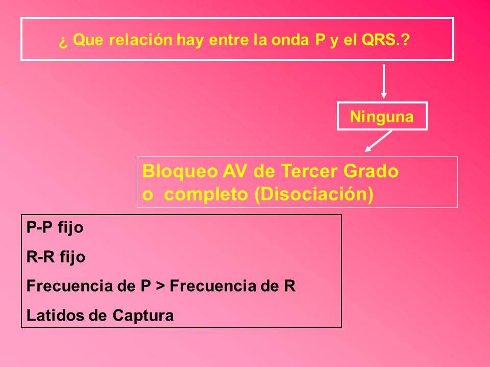 ¿ Que relación hay entre la onda P y el QRS.