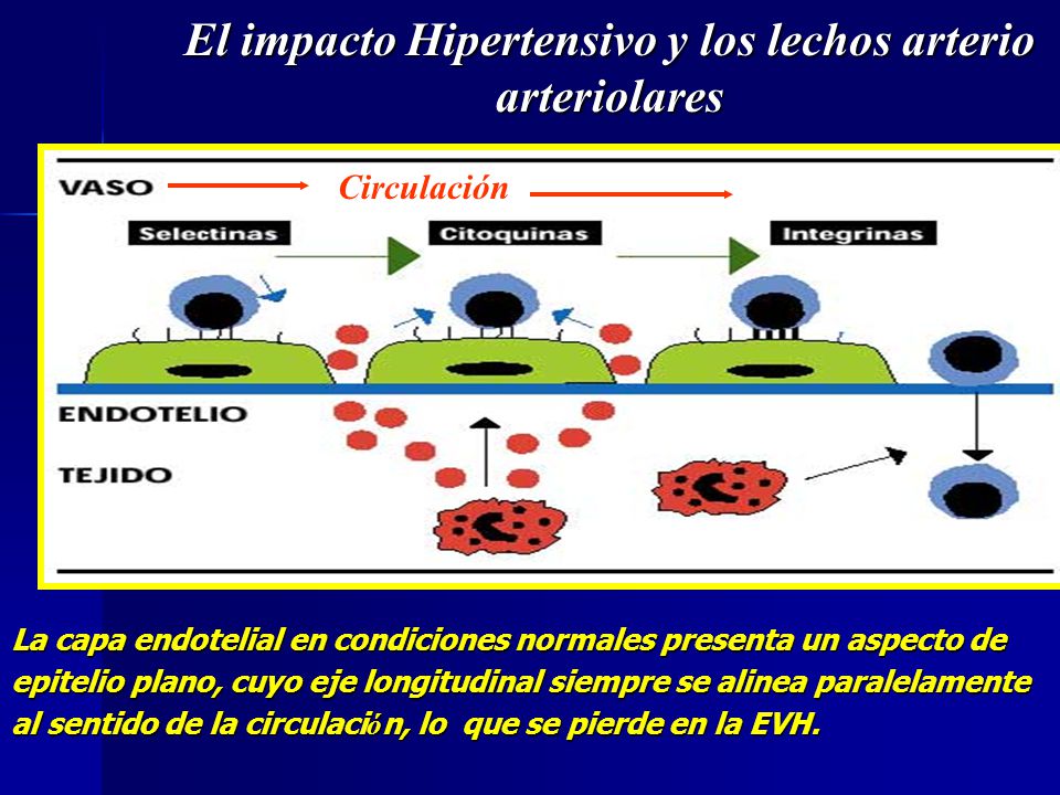 El impacto Hipertensivo y los lechos arterio arteriolares