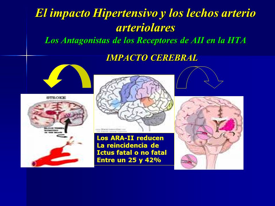 El impacto Hipertensivo y los lechos arterio arteriolares Los Antagonistas de los Receptores de AII en la HTA