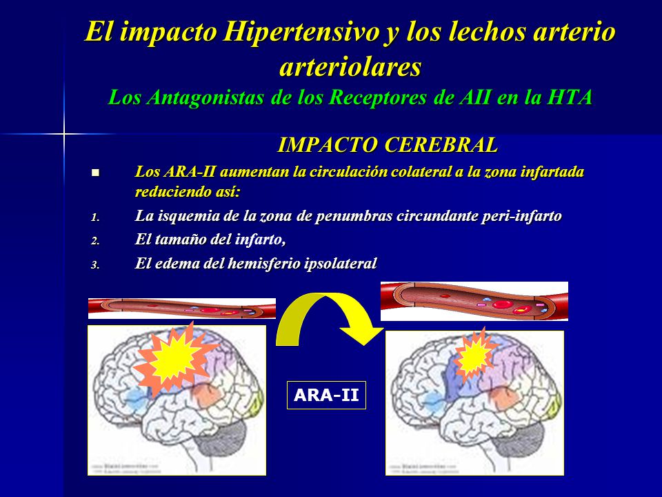 El impacto Hipertensivo y los lechos arterio arteriolares Los Antagonistas de los Receptores de AII en la HTA