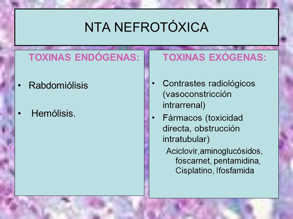 NTA NEFROTÓXICA TOXINAS ENDÓGENAS: Rabdomiólisis Hemólisis.