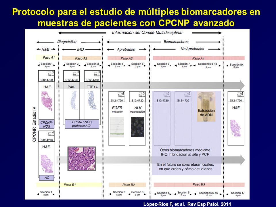 Protocolo para el estudio de múltiples biomarcadores en muestras de pacientes con CPCNP avanzado