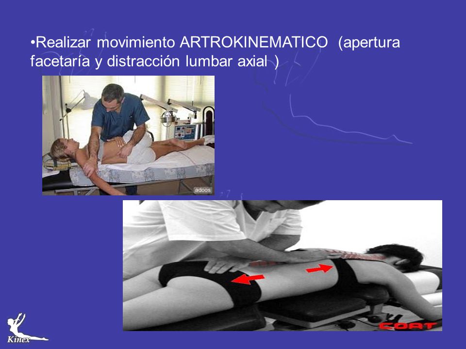 Realizar movimiento ARTROKINEMATICO (apertura facetaría y distracción lumbar axial )