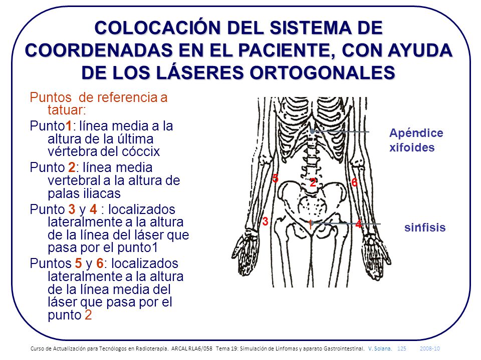 COLOCACIÓN DEL SISTEMA DE COORDENADAS EN EL PACIENTE, CON AYUDA DE LOS LÁSERES ORTOGONALES