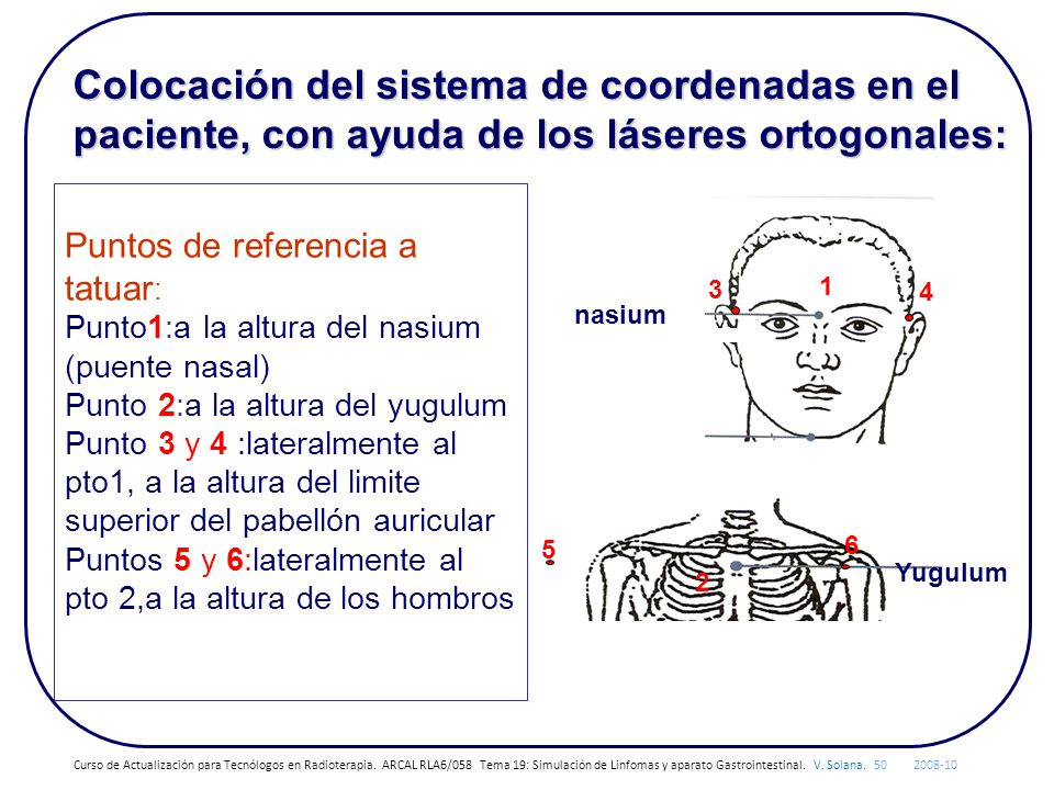 Colocación del sistema de coordenadas en el paciente, con ayuda de los láseres ortogonales: