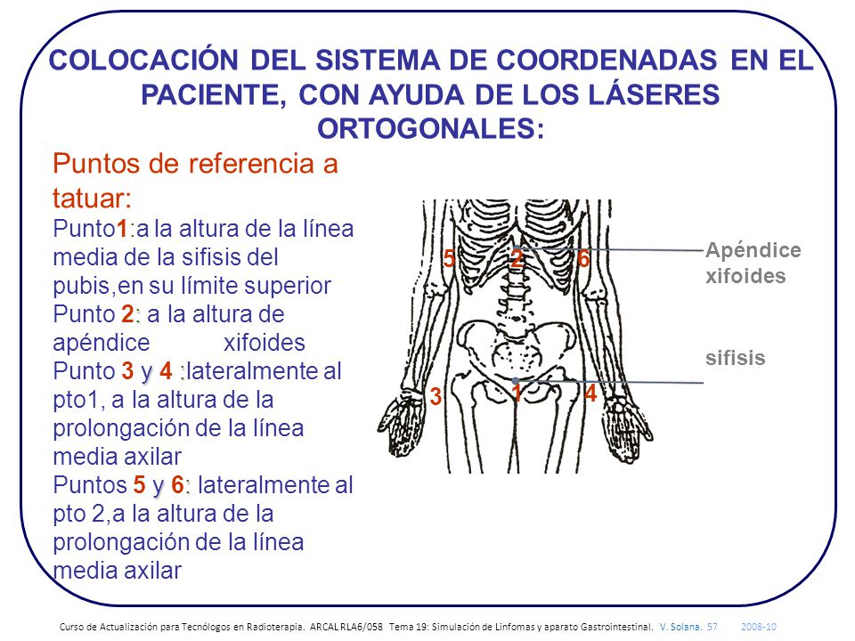 COLOCACIÓN DEL SISTEMA DE COORDENADAS EN EL PACIENTE, CON AYUDA DE LOS LÁSERES ORTOGONALES: