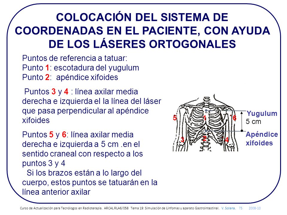 COLOCACIÓN DEL SISTEMA DE COORDENADAS EN EL PACIENTE, CON AYUDA DE LOS LÁSERES ORTOGONALES