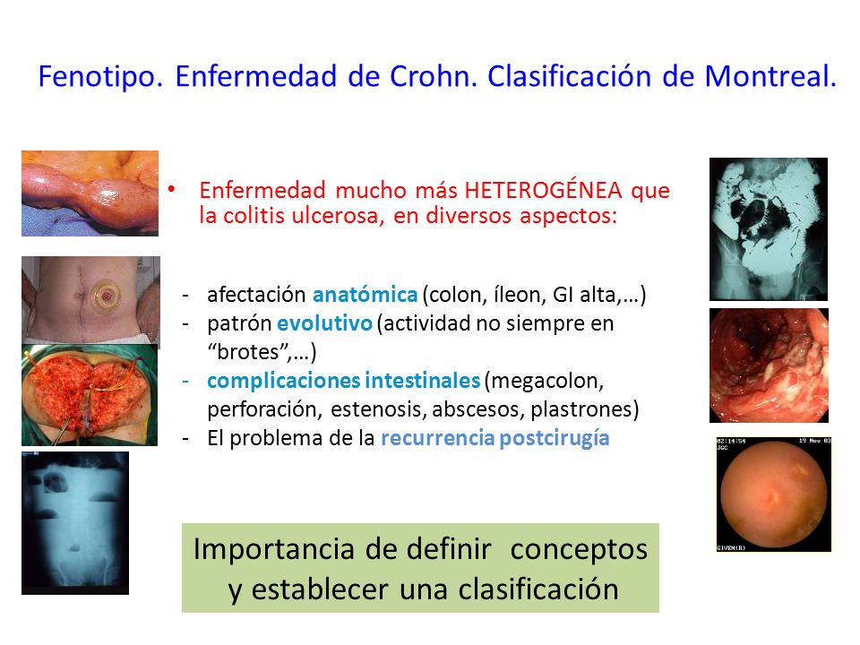 Fenotipo. Enfermedad de Crohn. Clasificación de Montreal.