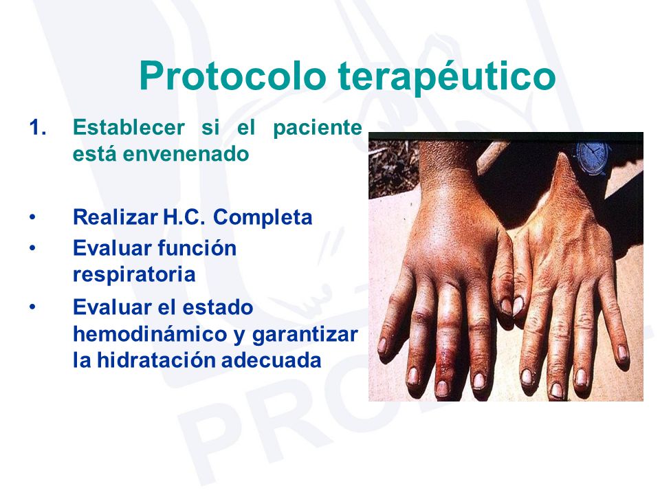 Protocolo terapéutico 1. Establecer si el paciente está envenenado •
