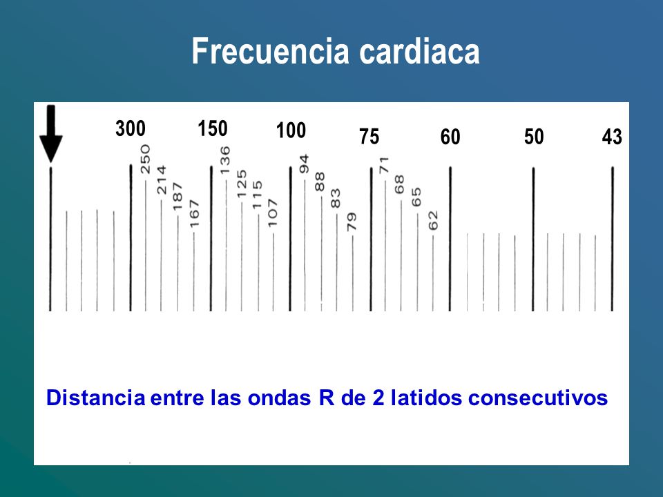 Frecuencia cardiaca Distancia entre las ondas R de 2 latidos consecutivos