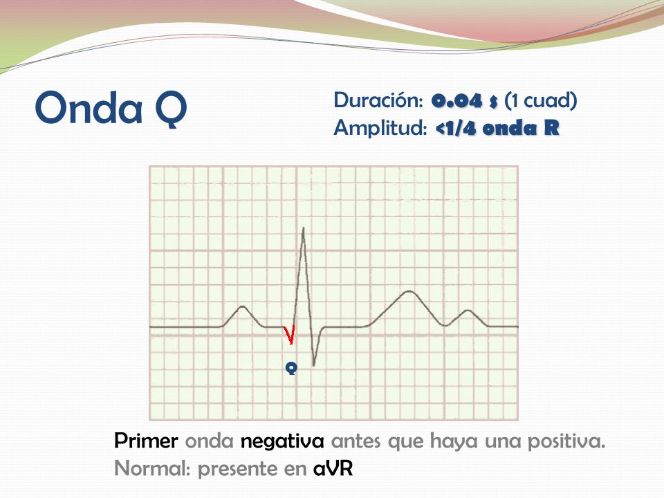 Onda Q Duración: 0.04 s (1 cuad) Amplitud: <1/4 onda R