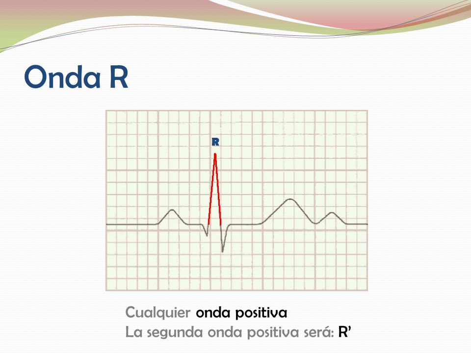 Onda R R Cualquier onda positiva La segunda onda positiva será: R’