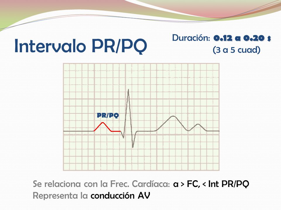 Intervalo PR/PQ Duración: 0.12 a 0.20 s (3 a 5 cuad)