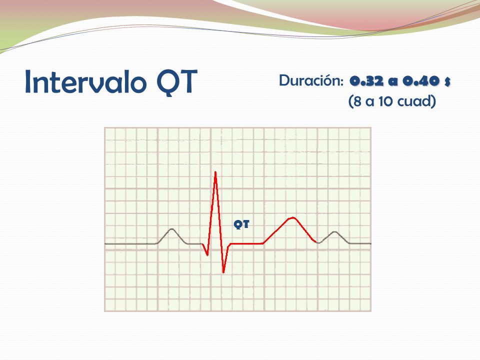 Intervalo QT Duración: 0.32 a 0.40 s (8 a 10 cuad) QT