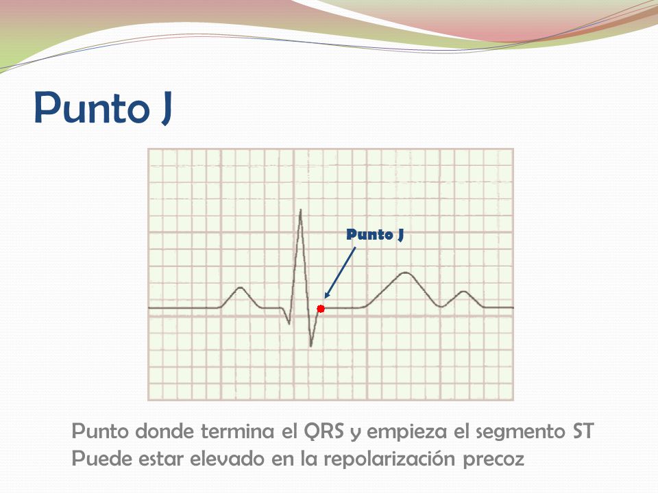 Punto J Punto donde termina el QRS y empieza el segmento ST