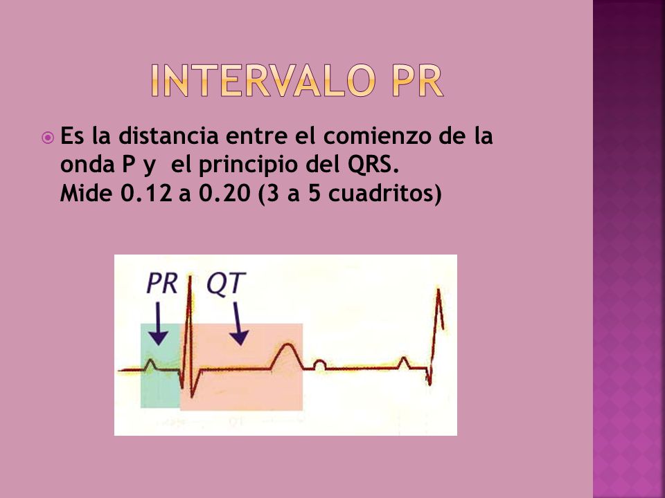 Intervalo pr Es la distancia entre el comienzo de la onda P y el principio del QRS.