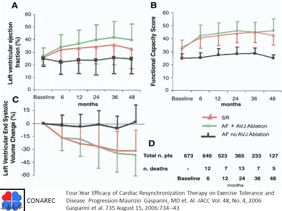 Four-Year Efﬁcacy of Cardiac Resynchronization Therapy on Exercise Tolerance and Disease Progression-Maurizio Gasparini, MD et. Al -JACC Vol. 48, No. 4, 2006 Gasparini et al. 735 August 15, 2006:734 –43