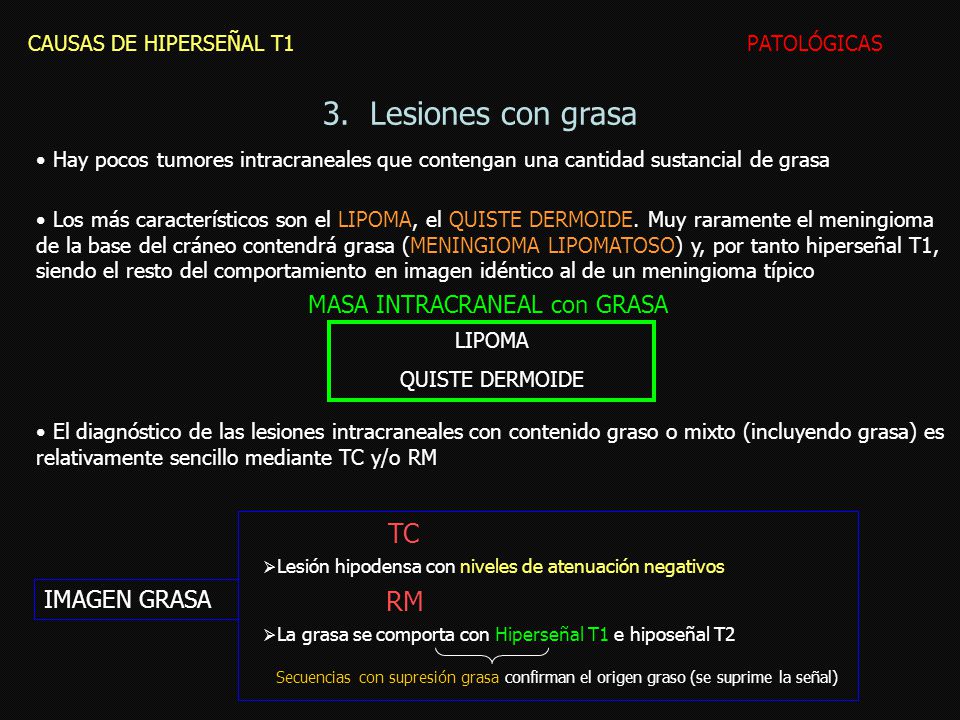 3. Lesiones con grasa TC RM MASA INTRACRANEAL con GRASA IMAGEN GRASA