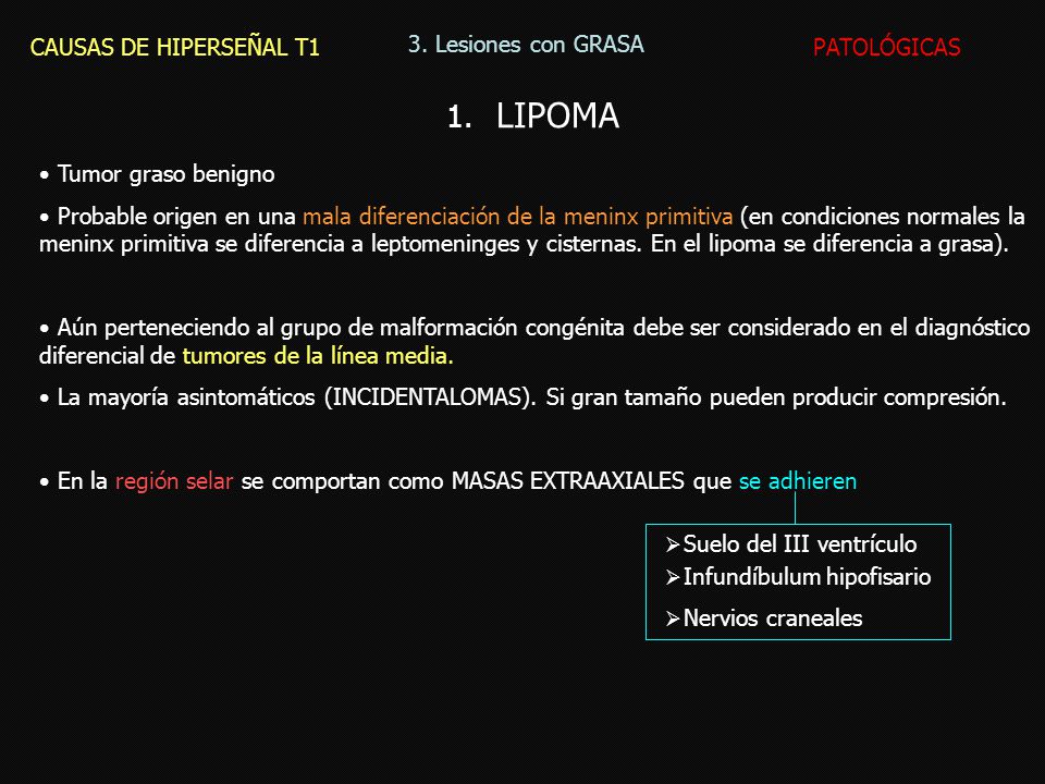 LIPOMA CAUSAS DE HIPERSEÑAL T1 3. Lesiones con GRASA PATOLÓGICAS