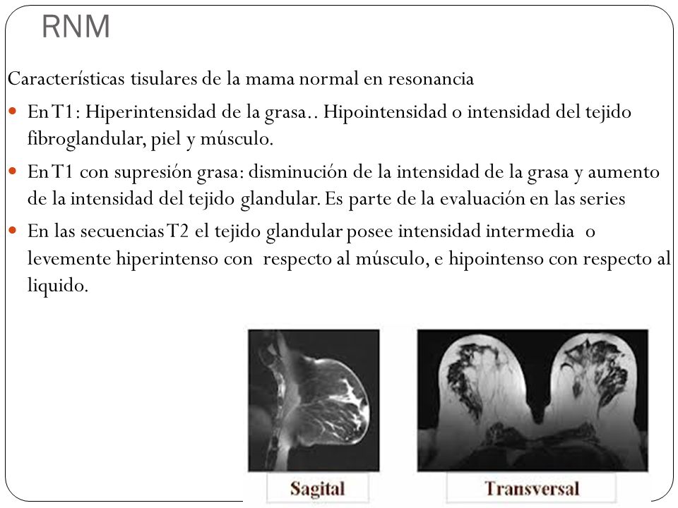 RNM Características tisulares de la mama normal en resonancia