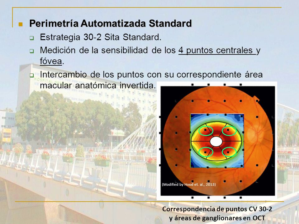 Correspondencia de puntos CV 30-2 y áreas de ganglionares en OCT