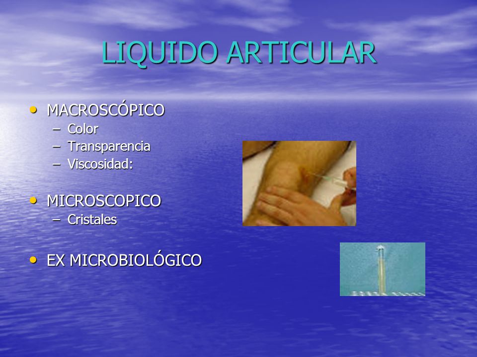 LIQUIDO ARTICULAR MACROSCÓPICO MICROSCOPICO EX MICROBIOLÓGICO Color