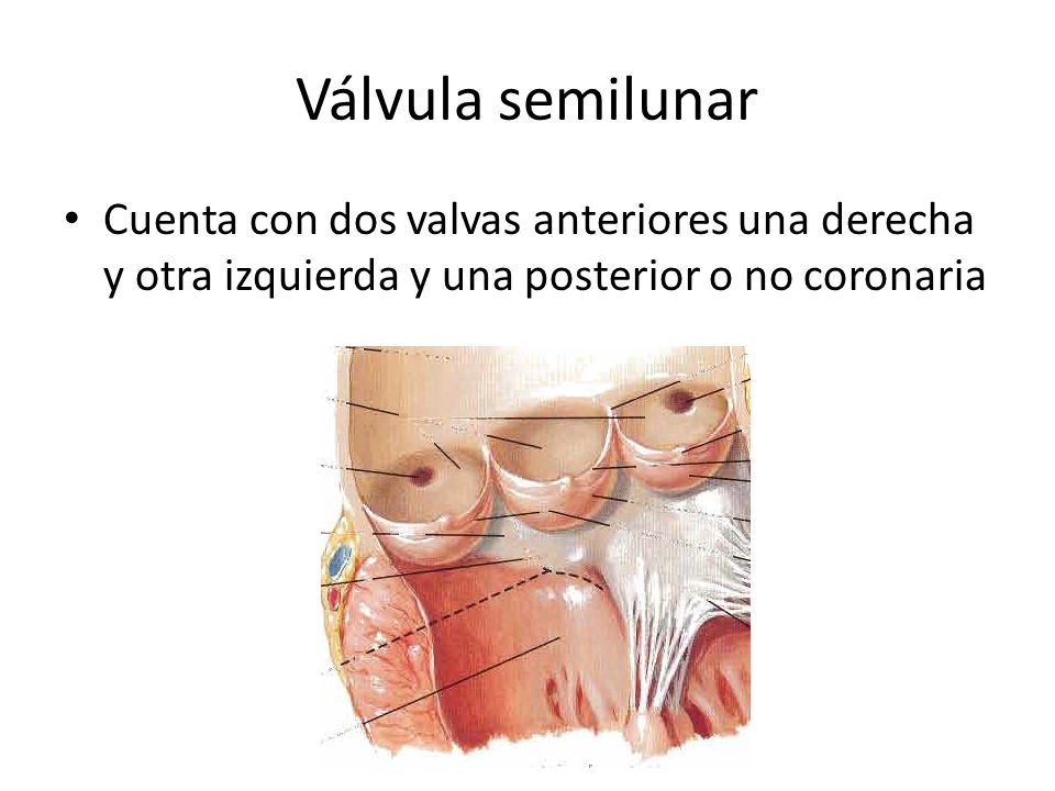 Válvula semilunar Cuenta con dos valvas anteriores una derecha y otra izquierda y una posterior o no coronaria.