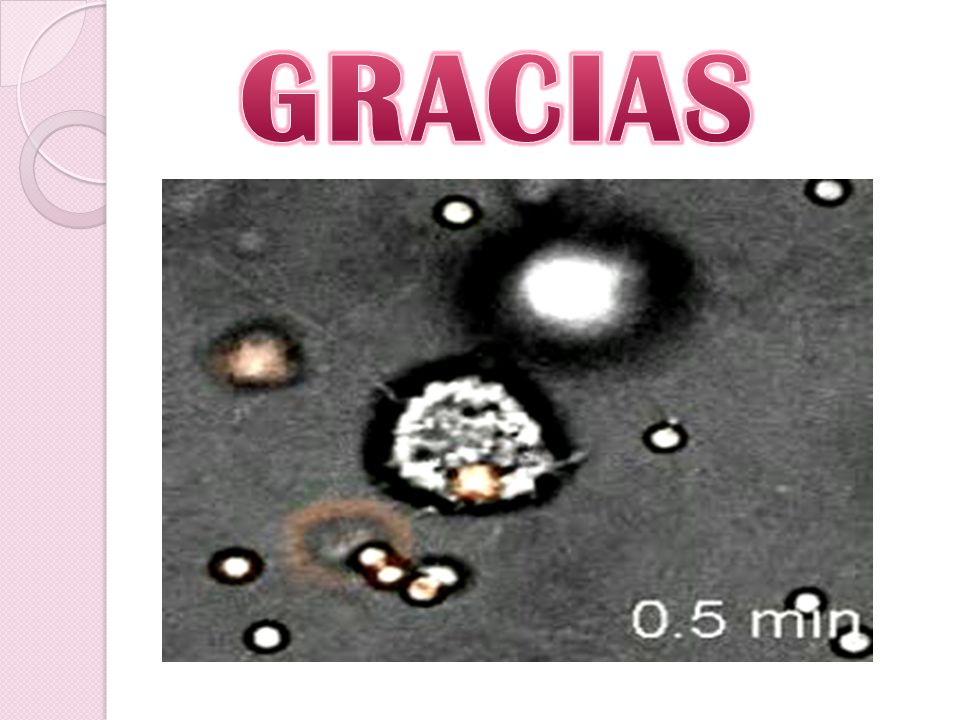GRACIAS