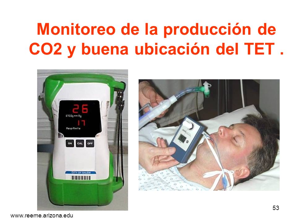 Monitoreo de la producción de CO2 y buena ubicación del TET .