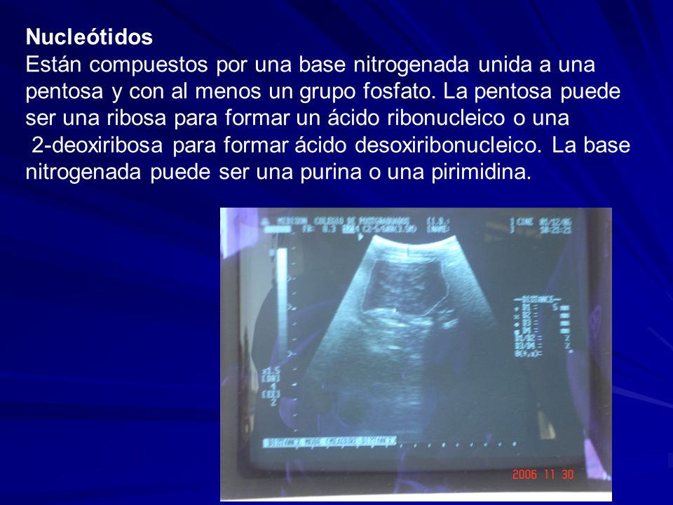 Nucleótidos Están compuestos por una base nitrogenada unida a una. pentosa y con al menos un grupo fosfato. La pentosa puede.