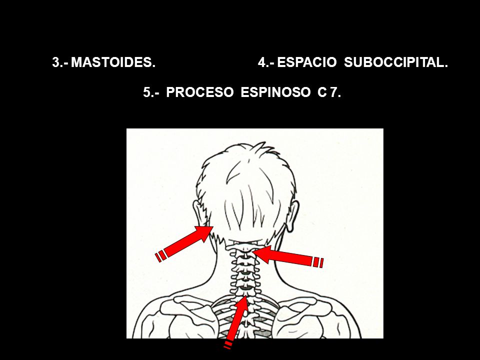 3.- MASTOIDES. 4.- ESPACIO SUBOCCIPITAL. 5.- PROCESO ESPINOSO C 7.