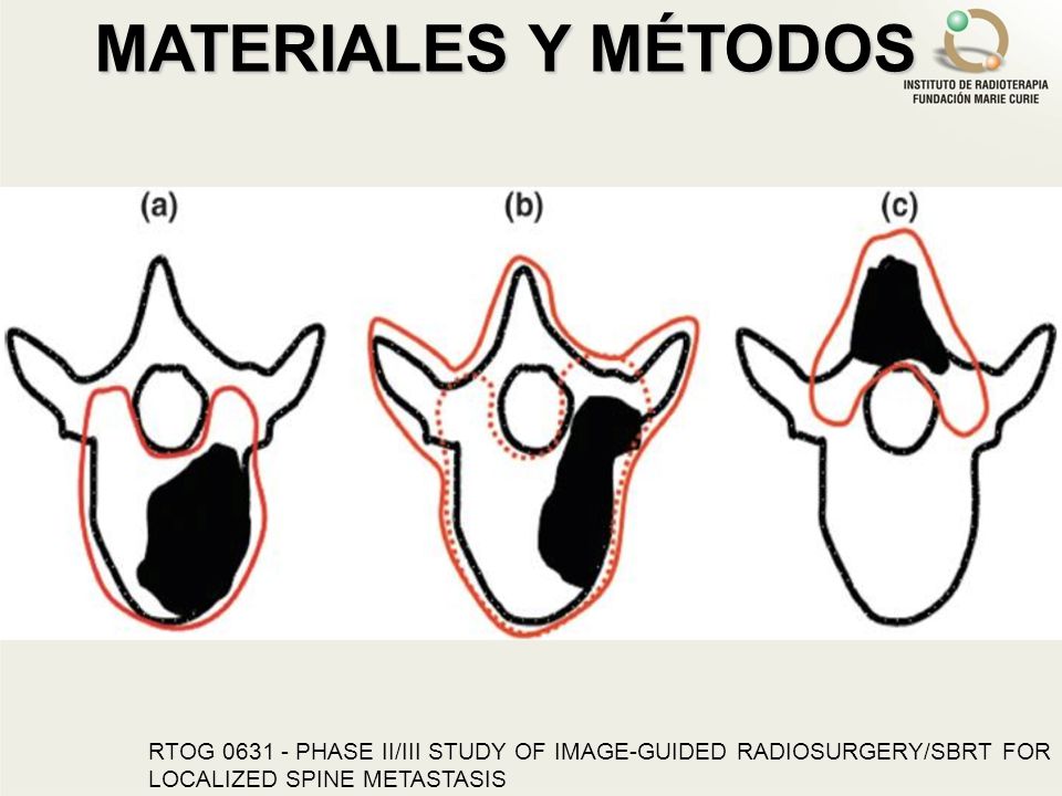 MATERIALES Y MÉTODOS RTOG PHASE II/III STUDY OF IMAGE-GUIDED RADIOSURGERY/SBRT FOR LOCALIZED SPINE METASTASIS.