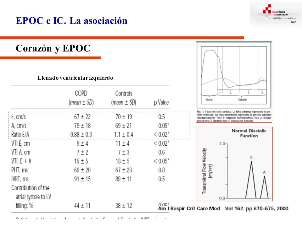 EPOC e IC. La asociación Corazón y EPOC Llenado ventricular izquierdo