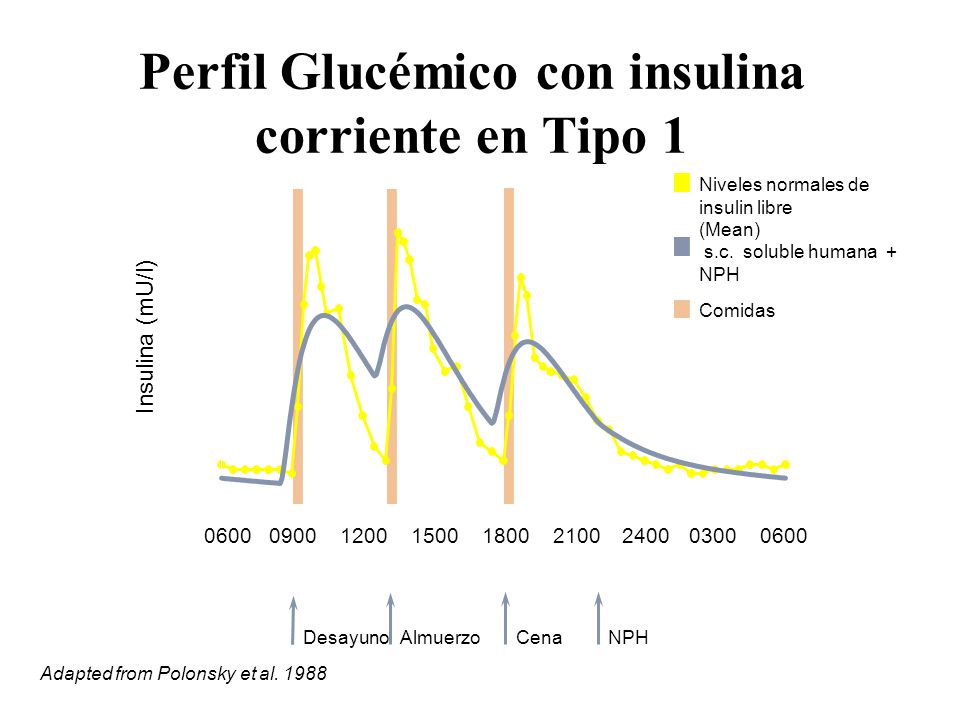 Perfil Glucémico con insulina corriente en Tipo 1