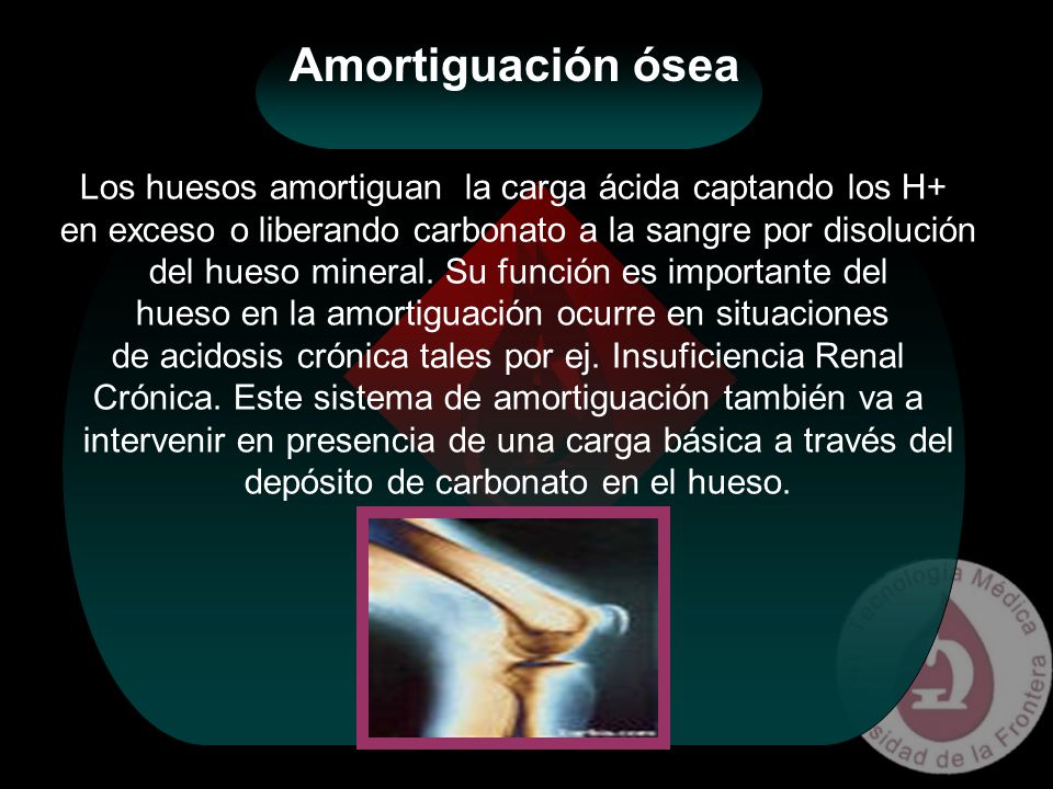 Amortiguación ósea Los huesos amortiguan la carga ácida captando los H+ en exceso o liberando carbonato a la sangre por disolución.