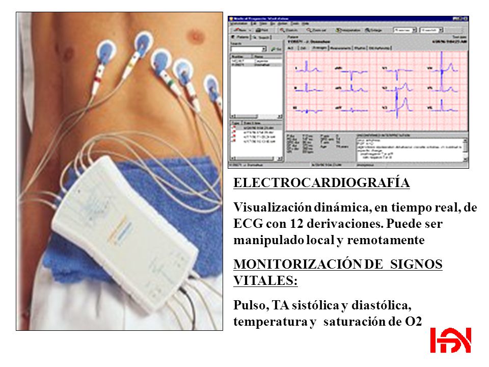 ELECTROCARDIOGRAFÍA Visualización dinámica, en tiempo real, de ECG con 12 derivaciones. Puede ser manipulado local y remotamente.