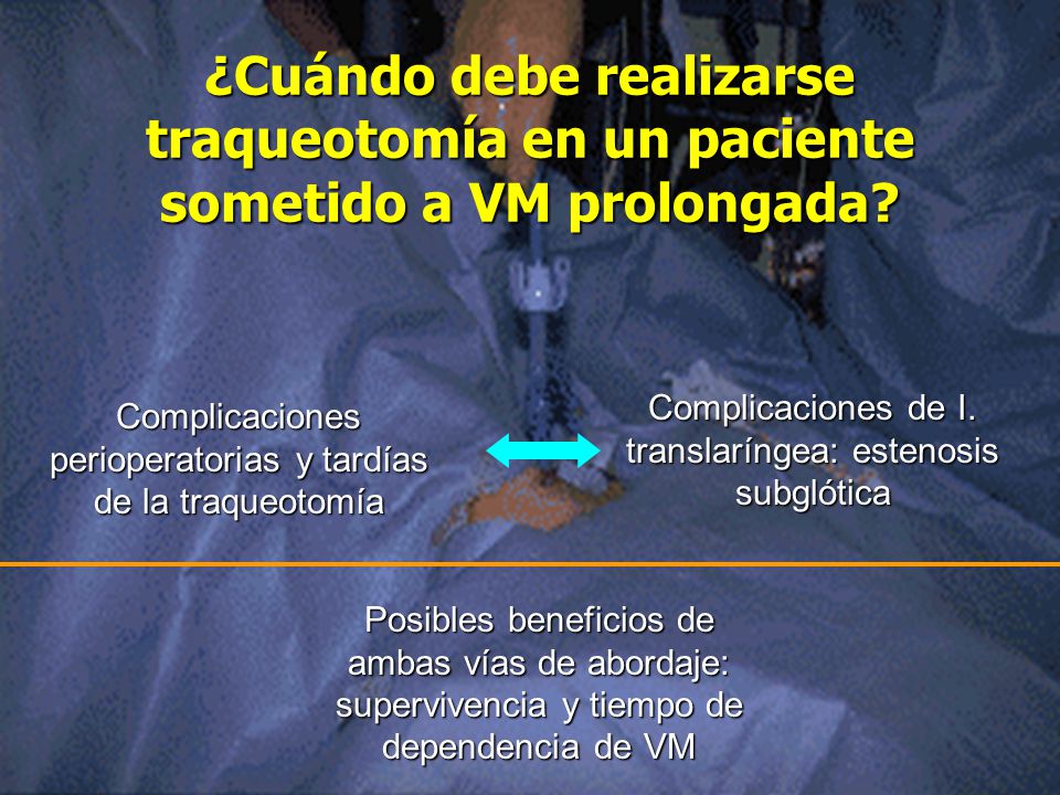 ¿Cuándo debe realizarse traqueotomía en un paciente sometido a VM prolongada
