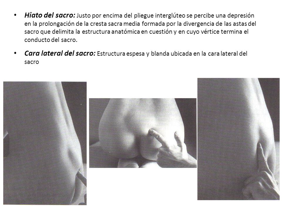Hiato del sacro: Justo por encima del pliegue interglúteo se percibe una depresión en la prolongación de la cresta sacra media formada por la divergencia de las astas del sacro que delimita la estructura anatómica en cuestión y en cuyo vértice termina el conducto del sacro.