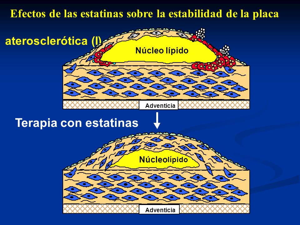 Efectos de las estatinas sobre la estabilidad de la placa