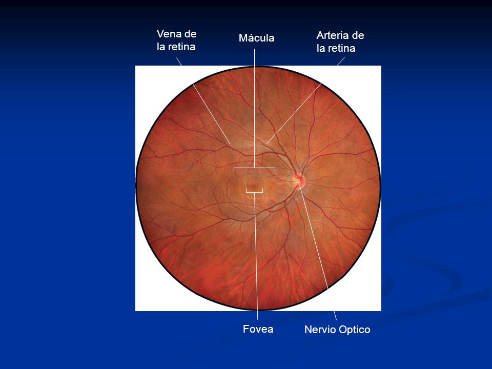 Vena de la retina Mácula Arteria de la retina Fovea Nervio Optico