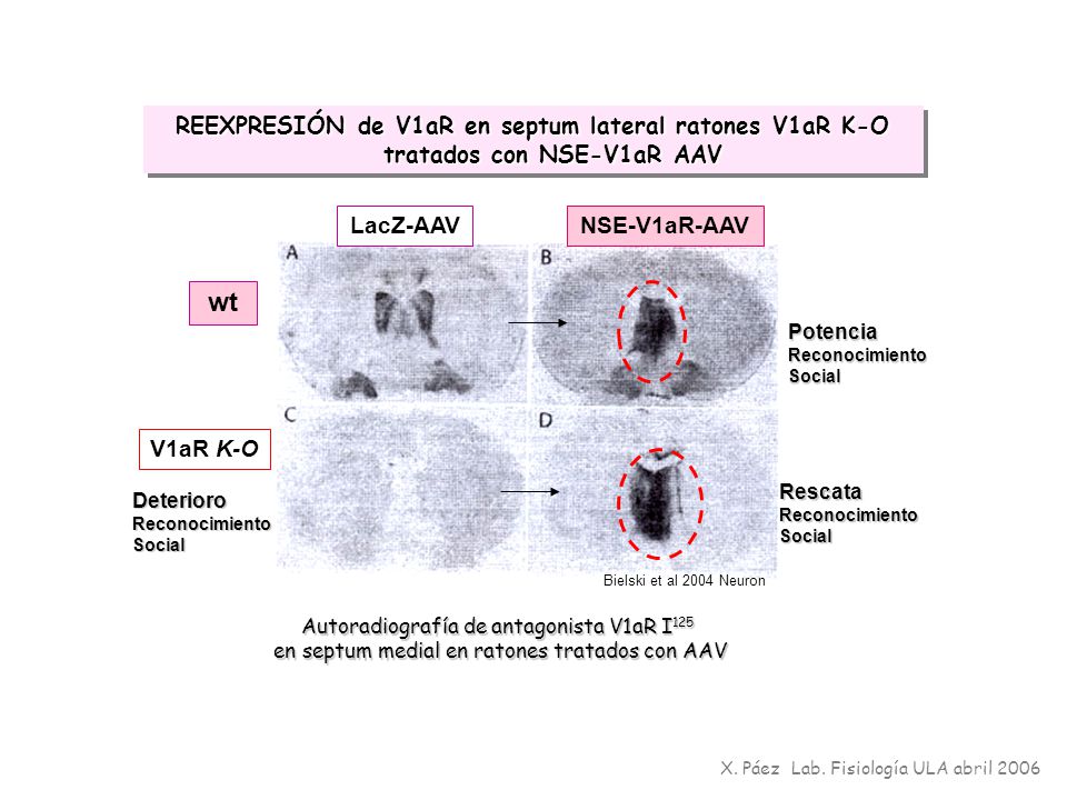 REEXPRESIÓN de V1aR en septum lateral ratones V1aR K-O tratados con NSE-V1aR AAV