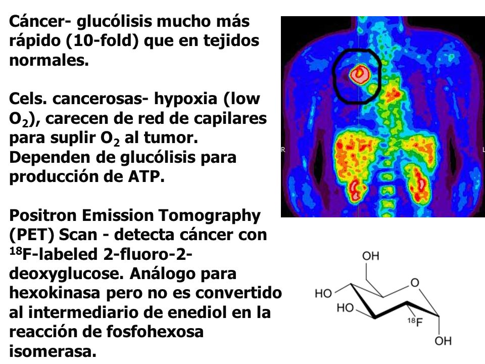 Cáncer- glucólisis mucho más rápido (10-fold) que en tejidos normales.