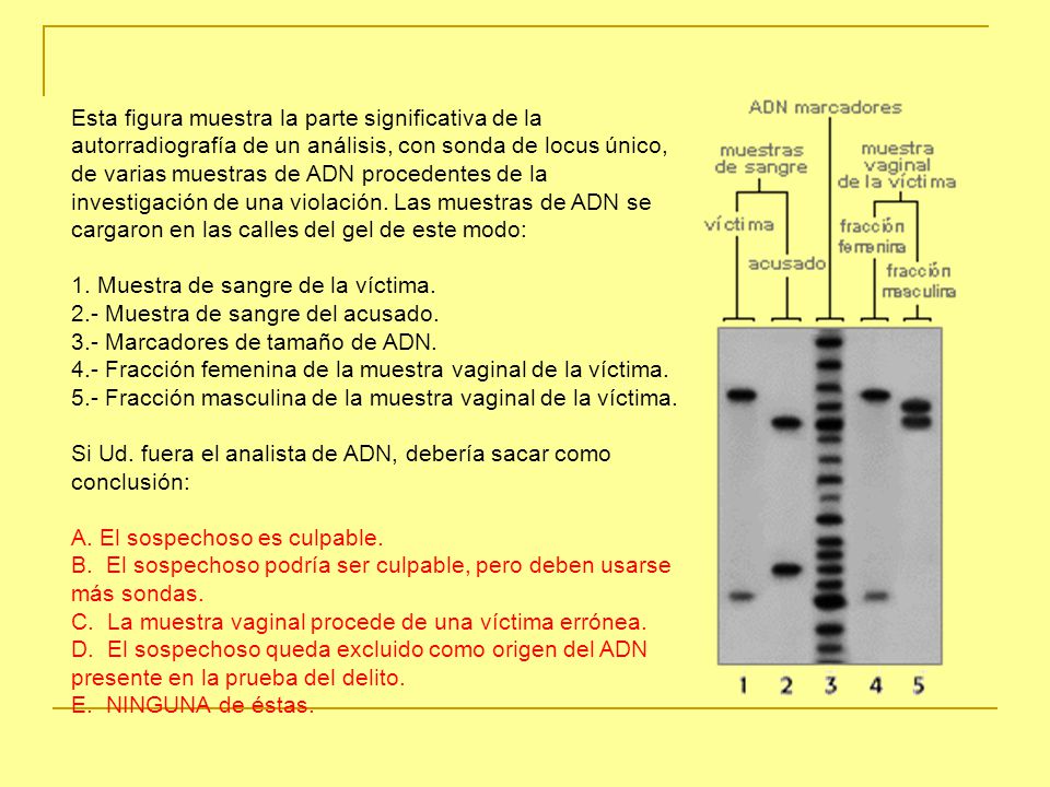 Esta figura muestra la parte significativa de la autorradiografía de un análisis, con sonda de locus único, de varias muestras de ADN procedentes de la investigación de una violación. Las muestras de ADN se cargaron en las calles del gel de este modo: