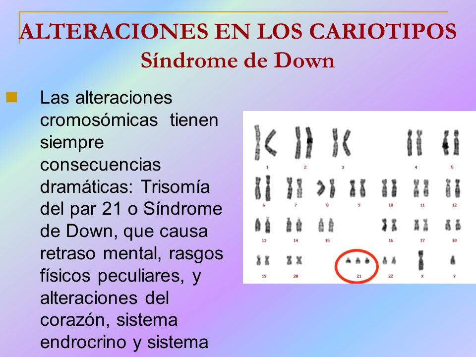ALTERACIONES EN LOS CARIOTIPOS Síndrome de Down