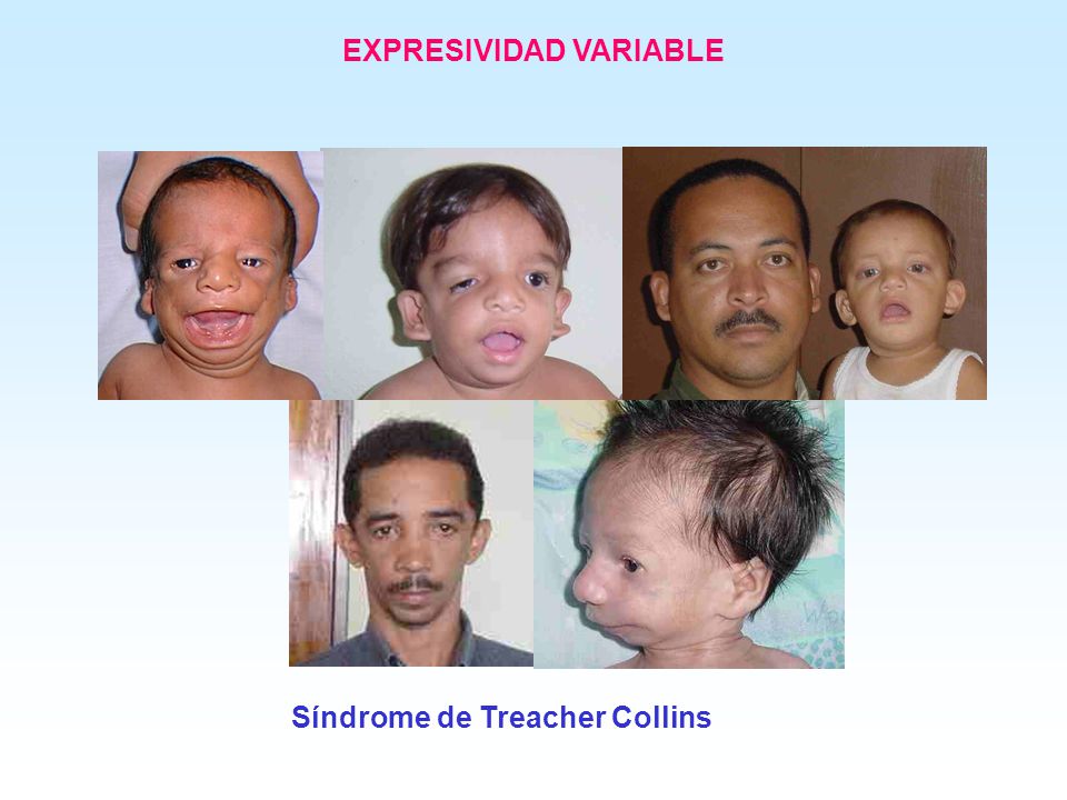 EXPRESIVIDAD VARIABLE
