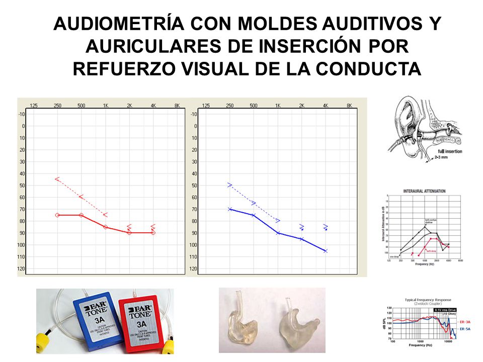 AUDIOMETRÍA CON MOLDES AUDITIVOS Y AURICULARES DE INSERCIÓN POR REFUERZO VISUAL DE LA CONDUCTA