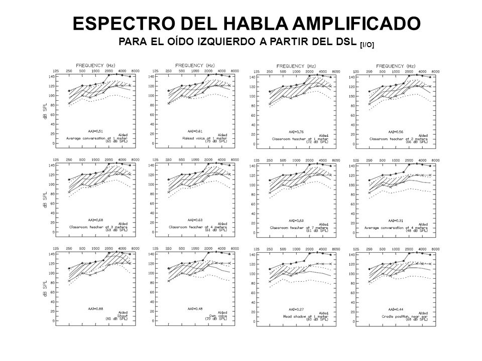 ESPECTRO DEL HABLA AMPLIFICADO PARA EL OÍDO IZQUIERDO A PARTIR DEL DSL [I/O]