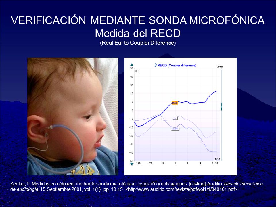 VERIFICACIÓN MEDIANTE SONDA MICROFÓNICA Medida del RECD (Real Ear to Coupler Diference)
